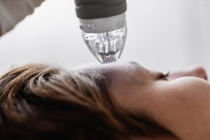 ¿Puedes contraer una infección por microneedling?